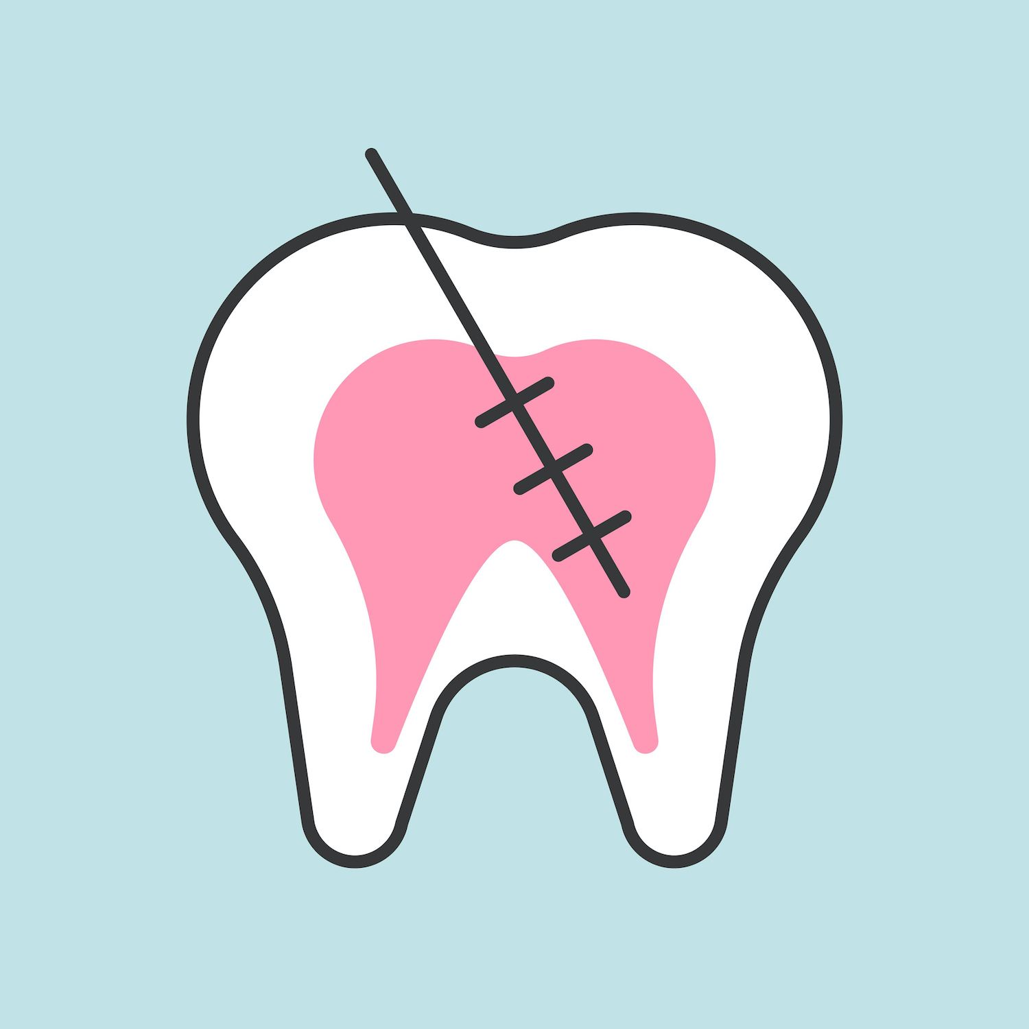 What to Expect From a Root Canal McLeansville, NC Dentist